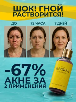Распродажа 